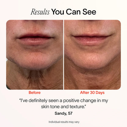 The Red Light Therapy Wand