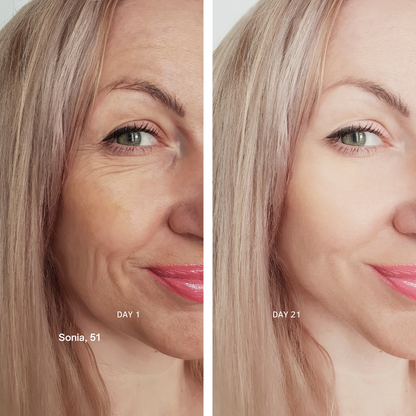 The Red Light Therapy Wand